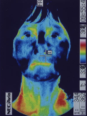 Thermography test for stress conditions