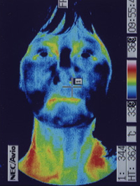 Thermography test for stress conditions