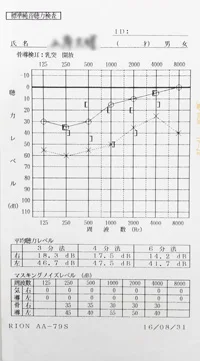 Sudden hearing loss