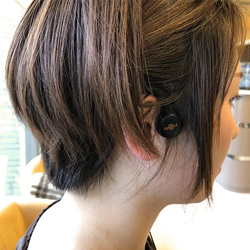 R.Y., Nagano, Japan, treated for sudden hearing loss with acupuncture and acoustic therapy